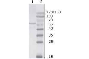 Western Blot testing of HIV-1 Gag p17/24 using HIV-1 p24 antibody, clone N13 (05-006). (HIV-1 p24 antibody  (C-Term))