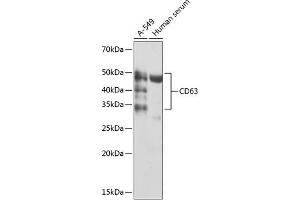 Western blot analysis of extracts of various cell lines, using CD63 antibody (ABIN7266210) at 1:1000 dilution. (CD63 antibody)