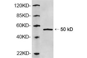 Western blot analysis of recombinant human AP2M1 protein using 1 µg/mL Rabbit Anti-AP2M1 Polyclonal Antibody (ABIN398781) The signal was developed with IRDyeTM 800 Conjugated Goat Anti-Rabbit IgG. (AP2M1 antibody  (N-Term))