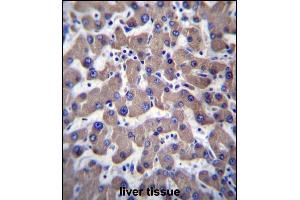 T Antibody (C-term) (ABIN656935 and ABIN2846127) immunohistochemistry analysis in formalin fixed and paraffin embedded human liver tissue followed by peroxidase conjugation of the secondary antibody and DAB staining.