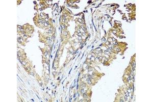 Immunohistochemistry of paraffin-embedded Human prostate using STK3 Polyclonal Antibody at dilution of 1:100 (40x lens). (STK3 antibody)