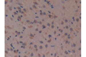 DAB staining on IHC-P; Samples: Mouse Brain Tissue (Complement Factor H antibody  (AA 915-1156))
