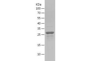 Western Blotting (WB) image for Axin 1 (AXIN1) (AA 540-768) protein (His tag) (ABIN7283001) (Axin Protein (AA 540-768) (His tag))