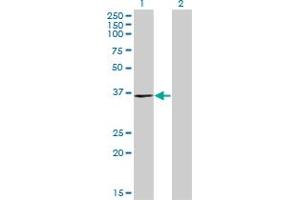 Western Blot analysis of C20orf77 expression in transfected 293T cell line by C20orf77 monoclonal antibody (M04), clone 4D6.
