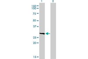 Western Blot analysis of FCER1A expression in transfected 293T cell line by FCER1A monoclonal antibody (M01), clone 2C12-3B6. (Fc epsilon RI/FCER1A antibody  (AA 1-257))