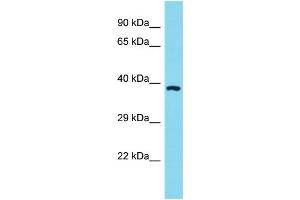 Host: Rabbit Target Name: OR11A1 Sample Type: HT1080 Whole Cell Lysate lysates Antibody Dilution: 1. (OR11A1 antibody  (C-Term))