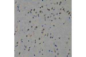 Immunohistochemistry of paraffin-embedded mouse brain using DNMT3B antibody at dilution of 1:200 (400x lens).