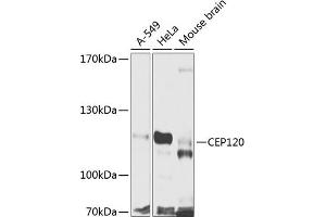 CEP120 antibody  (AA 1-270)