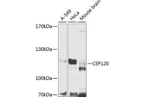 Western blot analysis of extracts of various cell lines, using CEP120 antibody (ABIN6133305, ABIN6138415, ABIN6138416 and ABIN6224025) at 1:1000 dilution. (CEP120 antibody  (AA 1-270))