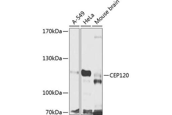 CEP120 antibody  (AA 1-270)