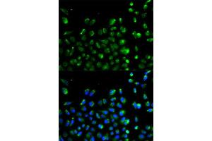 Immunofluorescence analysis of A549 cell using ATG13 antibody. (ATG13 antibody  (AA 281-480))