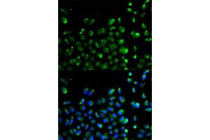 Immunofluorescence analysis of A549 cell using ATG13 antibody. (ATG13 antibody  (AA 281-480))