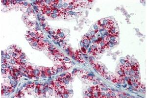 Human Prostate: Formalin-Fixed, Paraffin-Embedded (FFPE) (ASAH1 antibody  (AA 25-125))