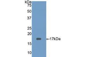 Western blot analysis of recombinant Human CD3d.