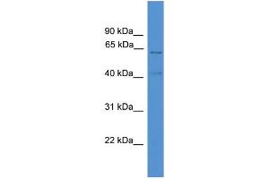 WB Suggested Anti-ACADVL  Antibody Titration: 0. (ACADVL antibody  (C-Term))