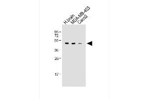All lanes : Anti-KCNJ13 Antibody (N-term) at 1:2000 dilution Lane 1: Human brain whole tissue lysate Lane 2: MDA-MB-453 whole cell lysate Lane 3: Caco2 whole cell lysate Lysates/proteins at 20 μg per lane.