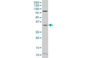 CRYZ polyclonal antibody (A01), Lot # 060707JCS1 Western Blot analysis of CRYZ expression in HL-60 . (CRYZ antibody  (AA 2-100))