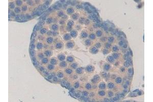Detection of FBLN1 in Rat Testis Tissue using Polyclonal Antibody to Fibulin 1 (FBLN1) (Fibulin 1 antibody  (AA 127-243))
