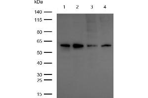Western Blotting (WB) image for anti-V-Yes-1 Yamaguchi Sarcoma Viral Oncogene Homolog 1 (YES1) antibody (ABIN7607008)