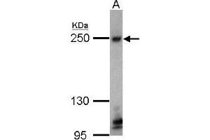 WB Image Sample (30 ug of whole cell lysate) (TJP1 antibody  (C-Term))