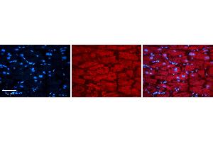 Immunohistochemistry (IHC) image for anti-TAR DNA Binding Protein (TARDBP) (N-Term) antibody (ABIN2776487)