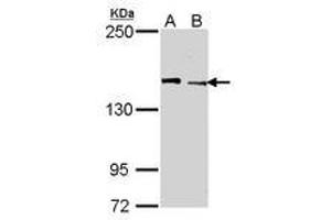 Image no. 1 for anti-Lysine (K)-Specific Demethylase 5C (KDM5C) (AA 10-261) antibody (ABIN467524) (KDM5C antibody  (AA 10-261))