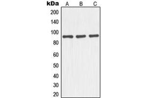 Western blot analysis of NOC3L expression in HEK293T (A), mouse liver (B), rat kidney (C) whole cell lysates. (NOC3L antibody  (Center))