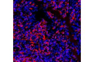 Immunofluorescence of paraffin embedded human tonsil using septin1 (ABIN7074453) at dilution of 1: 650 (400x lens) (LARP1 antibody)