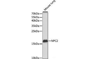 Western blot analysis of extracts of Mouse lung using NPC2 Polyclonal Antibody at dilution of 1:1000. (NPC2 antibody)