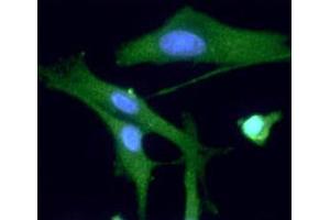 ICC/IF analysis of PGP9. (UCHL1 antibody  (AA 1-223))
