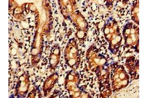 Immunohistochemistry of paraffin-embedded human small intestine tissue using ABIN7144337 at dilution of 1:100 (SERPINC1 antibody  (AA 37-180))
