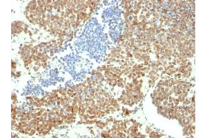 Immunohistochemistry (IHC) image for anti-BMI1 Polycomb Ring Finger Oncogene (BMI1) (AA 142-326) antibody (ABIN6940581)