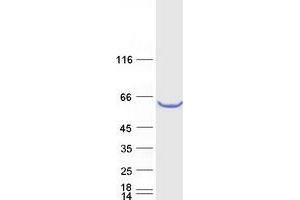 Western Blotting (WB) image for TBC1 Domain Family, Member 24 (TBC1D24) protein (Myc-DYKDDDDK Tag) (ABIN2733272)