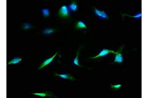 Immunofluorescence staining of U251 cells with ABIN7158941 at 1:133, counter-stained with DAPI. (MDH1 antibody  (AA 1-334))