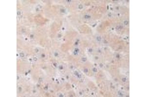 Detection of DRD1 in Human Liver Tissue using Polyclonal Antibody to Dopamine Receptor D1 (DRD1) (Dopamine Receptor d1 antibody  (AA 338-446))
