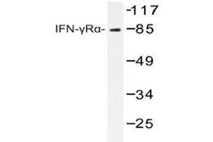 Western blot analyzes of IFNGRA antibody in extracts from COS7 cells. (IFNGR1 antibody)