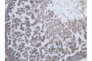 DAB staining on IHC-P; Samples: Rat Testis Tissue (SKAP1 antibody  (AA 1-354))