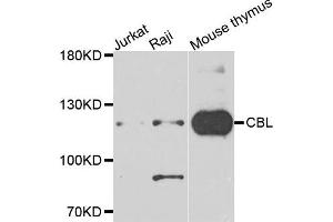 Western blot analysis of extracts of various cells, using CBL antibody.