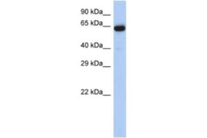 Western Blotting (WB) image for anti-Leucine Rich Repeat Transmembrane Neuronal 1 (LRRTM1) antibody (ABIN2463945)