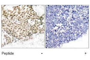 Image no. 1 for anti-Nibrin (NBN) (Ser343) antibody (ABIN197200) (Nibrin antibody  (Ser343))