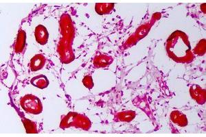 Anti-HSP110 / Heat Shock Protein 110 antibody IHC staining of human breast. (HSPH1 antibody)