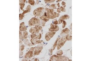 Immunohistochemical analysis of TITIN in Human heart tissue sections(IHC-P - paraformaldehyde-fixed, paraffin-embedded sections). (Titin antibody  (N-Term))