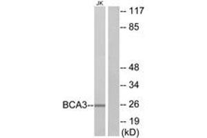 Western blot analysis of extracts from Jurkat cells, using BCA3 Antibody. (AKIP1 antibody  (AA 111-160))
