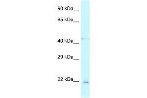 WB Suggested Anti-Twist1 Antibody Titration: 1.