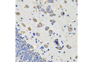 Immunohistochemistry of paraffin-embedded rat brain using GALNT2 Antibody (ABIN2562748) at dilution of 1:100 (40x lens).