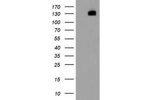 Western Blotting (WB) image for anti-Histone Deacetylase 6 (HDAC6) antibody (ABIN1498619)