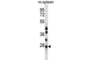 NQO2 Antibody (N-term) western blot analysis in mouse spleen tissue lysates (35µg/lane).