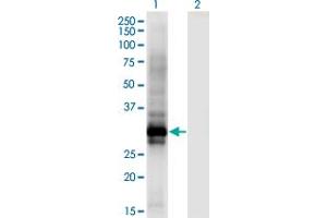 Western Blot analysis of HOXB6 expression in transfected 293T cell line by HOXB6 monoclonal antibody (M01), clone 8E3. (HOXB6 antibody  (AA 1-57))