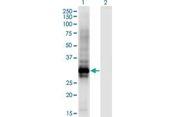 HOXB6 Antikörper  (AA 1-57)