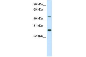 WB Suggested Anti-SPZ1 Antibody Titration:  2.